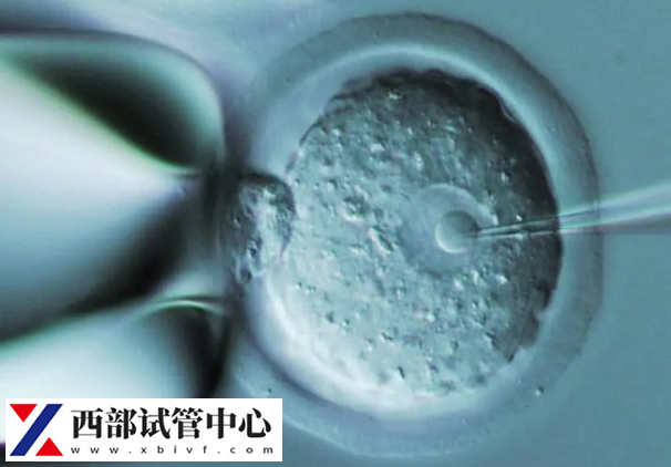 移植成功后食欲會發(fā)生變化