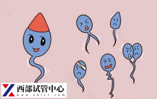 男性的精子分為死精和活精兩種